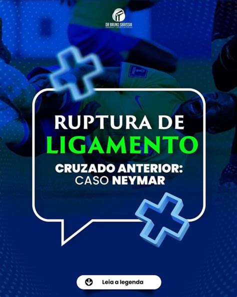 Ruptura De Ligamento Cruzado Anterior Caso Neymar Tratamento Do