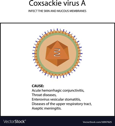 Structure of coxsackie virus a symptoms Royalty Free Vector