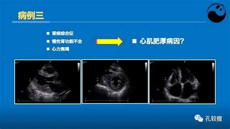 心脏超声报告不会看？这篇讲的够清楚！ 好医术文章 好医术 赋能医生守护生命