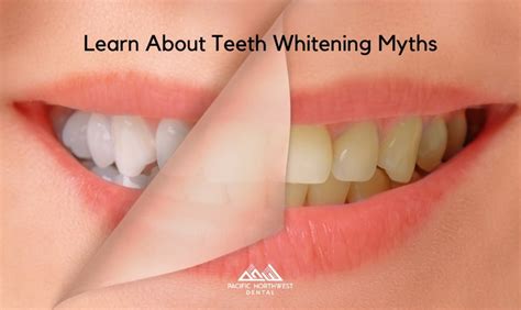 Debunking Teeth Whitening Myths