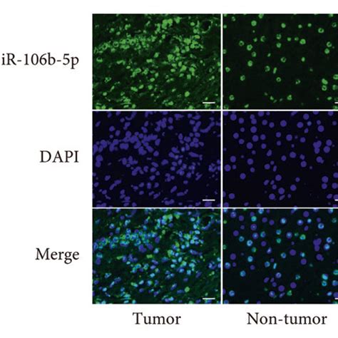 Mir 106b 5p Is Frequently Upregulated In Hcc Tissues And Cell Lines