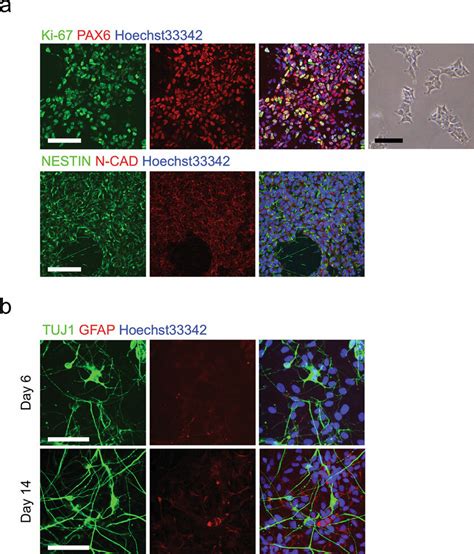 Characterization Of HiNPCs A Top Panel Representative Bright Field