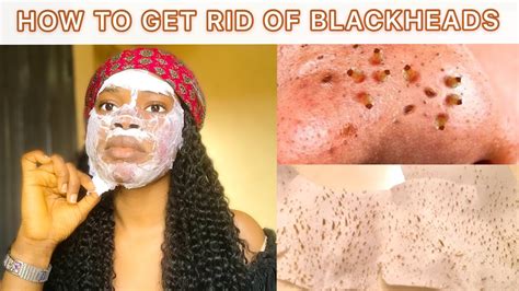 How To Remove Blackheads Blackheads And Whiteheads Peel Off Mask