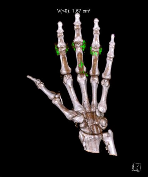 Sample Vrt Cor Page Radiology For Beginners By Dr Samuel Kobba