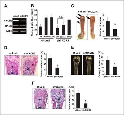 Gene Silencing Of Cxcr3 In Cancer Cells Reduces Bone Metastasis A