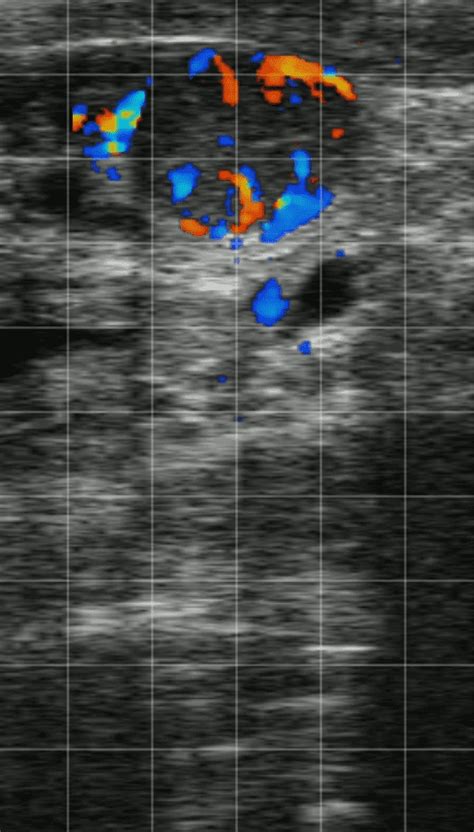 Easi Scango And Bovintel Veterinary Ultrasound Scanner Bovine