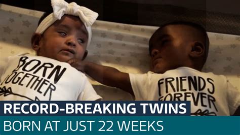 Premature Twins Celebrate Their First Birthday After Being Given Zero