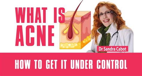 video   acne liver doctor