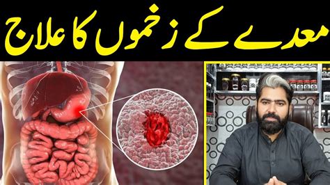 Maida K Zakham Ka Ilaj Stomach Ulcer Treatment Ulcer Ka Ilaj