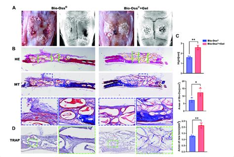 Histological Analysis Of The Critical Sized Calvarial Bone Defect Rat