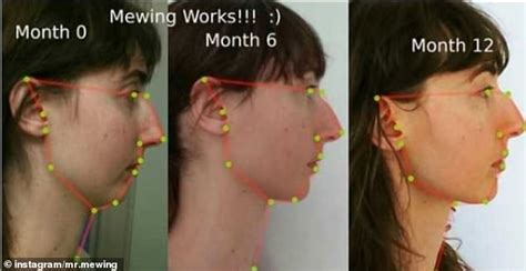 Mewing - no surgery method to reshape your jawline - AR15.COM