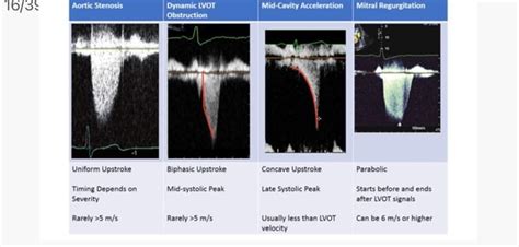 Pin van phuong hoai op Cardiac ultrasound