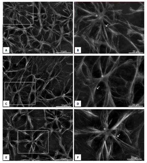 Representative Images Of Gfap Immunoreactivity In Whole Mount Retinae