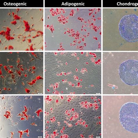 Osteogenic Adipogenic And Chondrogenic Differentiation Of Ucb Mscs In