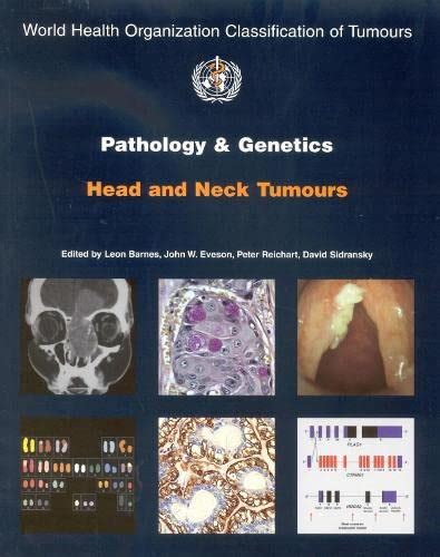 Pathology And Genetics Of Head And Neck Tumours Iarc