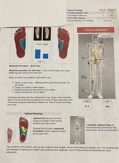 How to fix this? Flat feet and hips and shoulders misaligned (more info