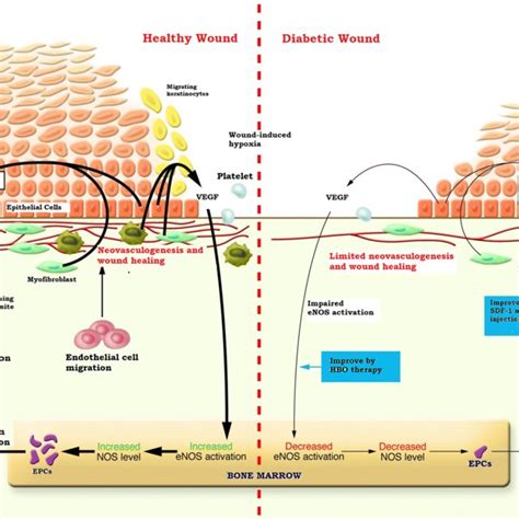 Molecular Representation Of Differences In Healthy Wound And Diabetic