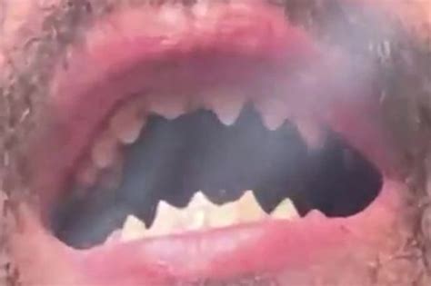 Man With Shark Teeth Accused Of Holding Pregnant Woman As Sex Slave For