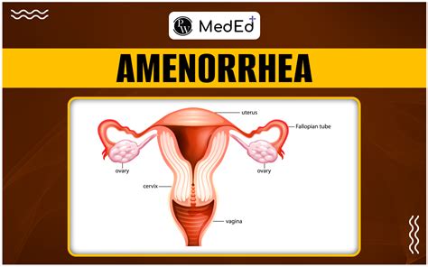 Amenorrhea Causes Symptoms Risk Factors And Treatment