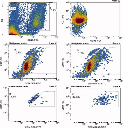 Flow cytometry on third sample case: CD45-negative cells of relevant ...