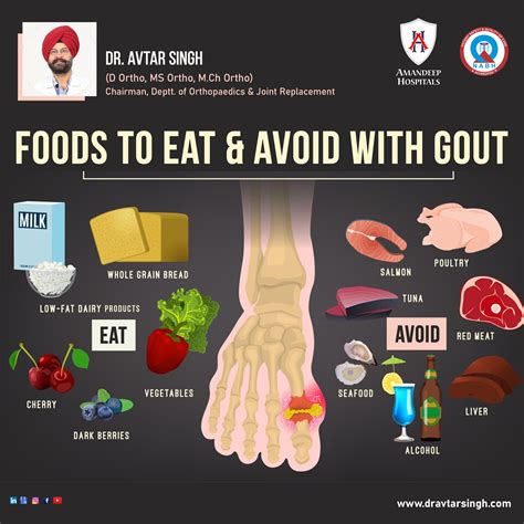 Stages Of Gout And Risk Factors All You Need To Know Artofit