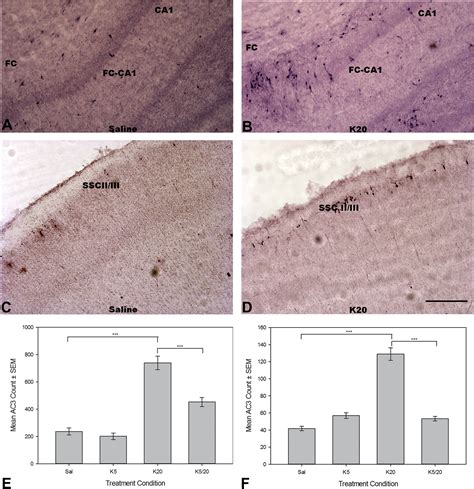 In Vivo And In Vitro Ketamine Exposure Exhibits A Dose Dependent