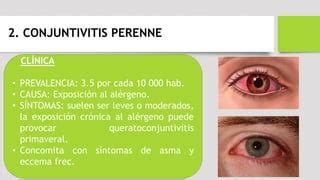 Conjuntivitis Alergica Marisol Ppt Descarga Gratuita