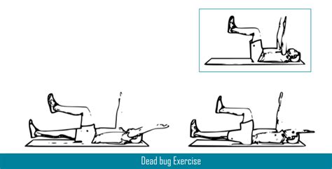 Top 10 Spondylolisthesis Exercises For Back Pain Relief