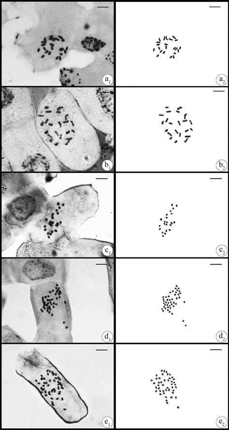 Somatic metaphase chromosome (1 = light microscope; 2 = outline ...