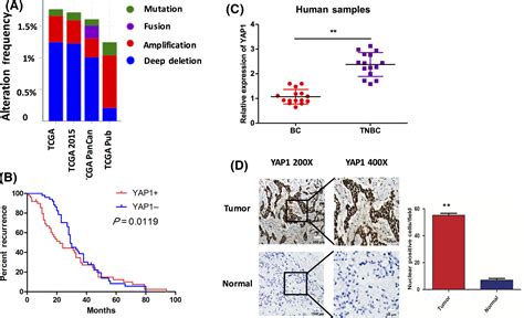 Role Of Inhibitor Of Yes‐associated Protein 1 In Triple‐negative Breast Cancer With Taxol‐based