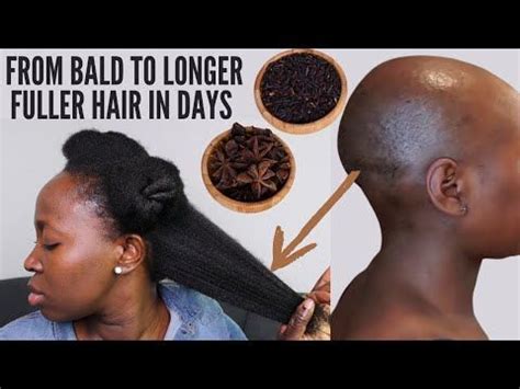 HOW I USE THIS SEEDS TO GROW MY BALDNESS ALOPECIA AND SHEDDING FAST IN