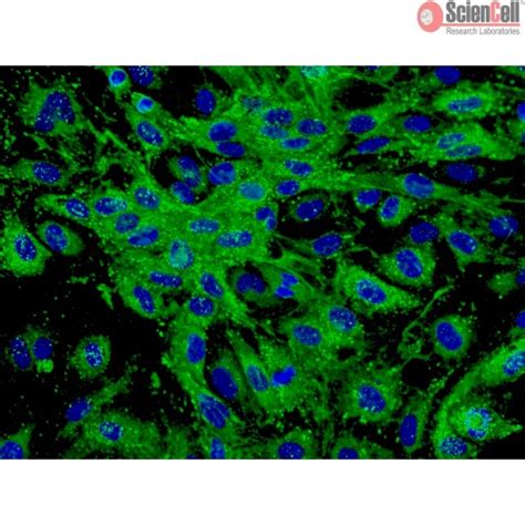 Sciencell Human Primary Endothelial Cells Team Medical Scientific