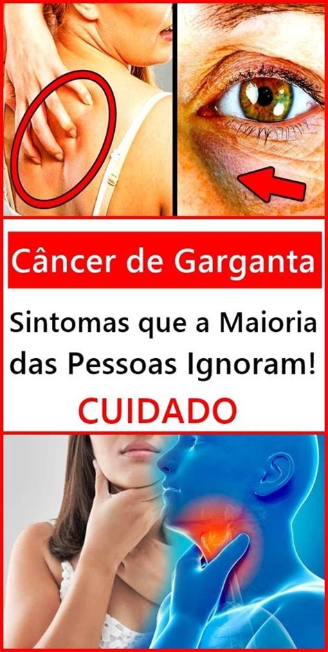 Câncer de Garganta Sintomas que a Maioria das Pessoas Ignoram