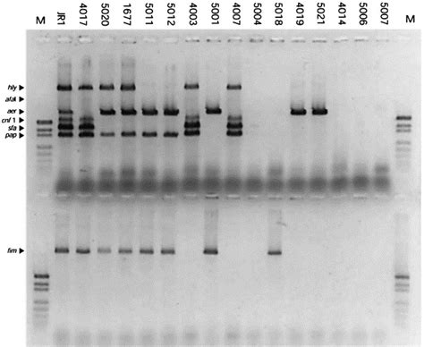 Identification Of Virulence Genes In Uropathogenic Escherichia Coli By