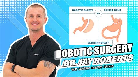 Robotic Sleeve To Gastric Bypass Youtube