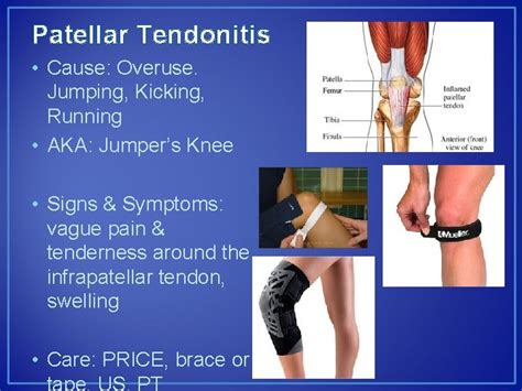 Chapter 16 The Knee Related Structures Bones Patella