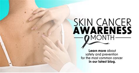 Lets Talk Skin Cancer Awareness Alamo Heights Dermatology