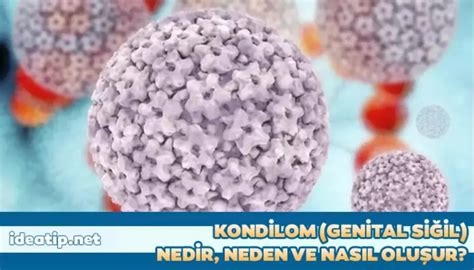 Kondilom Anal ve Genital Siğil Nedir ve Neden Oluşur