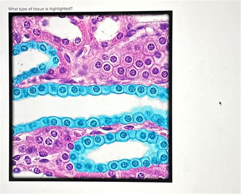 Solved What type of tissue is highlighted? | Chegg.com