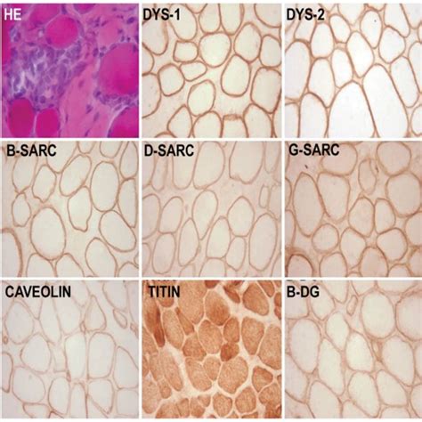 Transversely Cut Skeletal Muscle Tissue Stained For Haematoxylin And Download Scientific