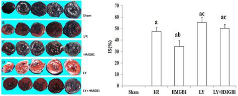 Frontiers Hmgb1 Protects The Heart Against Ischemiareperfusion