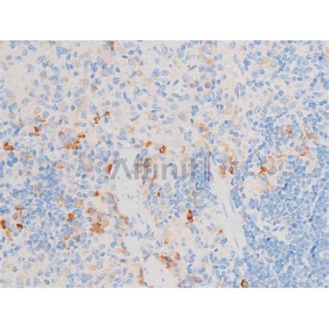 Phospho Smad23 Thr8 Antibody Affinity Biosciences Ltd亲科生物官网