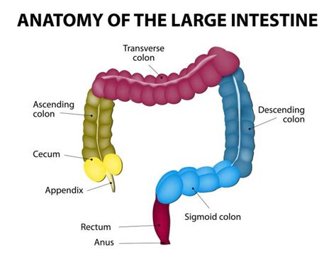 Colon Cancer Causes Symptoms And Treatments Medical News Today