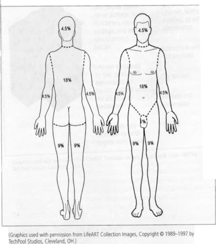 Emergency Med Exam Burns Wound Care And Hand Flashcards Quizlet