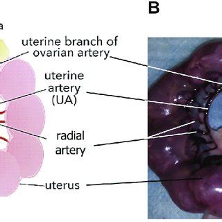 Uterine Arteries Anatomy