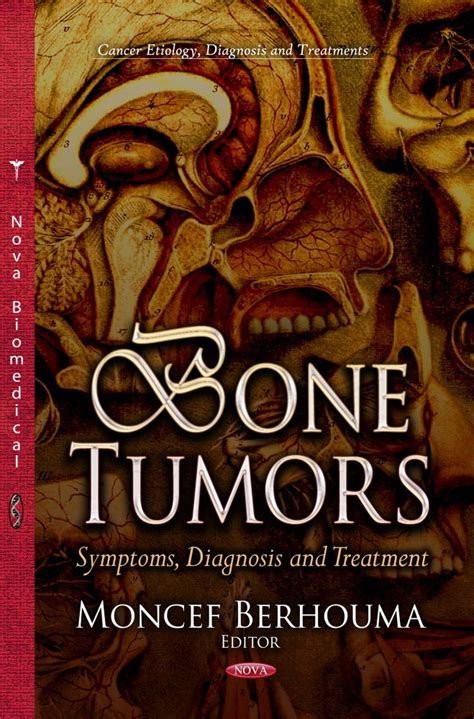 Bone Tumors: Symptoms, Diagnosis and Treatment – Nova Science Publishers