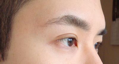 Are my eyebrows "sagging"? (photos) Doctor Answers, Tips