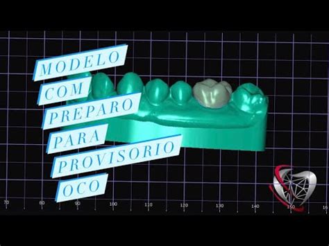 Como Fazer modelo preparo para provisório casca de ovo no exocad