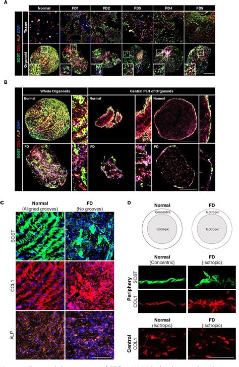 Figure From Patient Derived Organoids Recapitulate Pathological