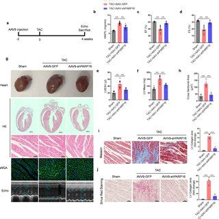 Parp Increases In Pathological Cardiac Hypertrophy Both In Vivo And